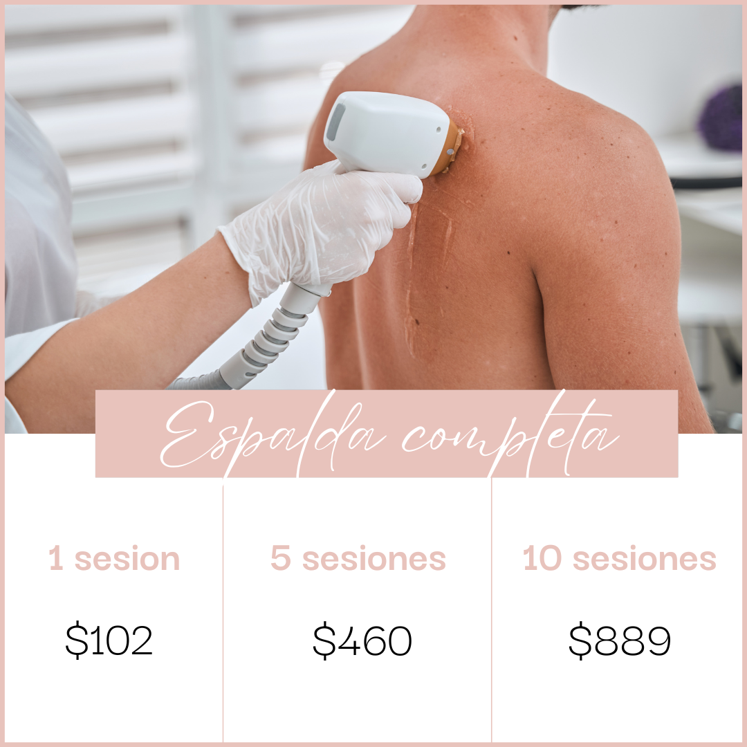 Láser en Espalda completa - Depósito de