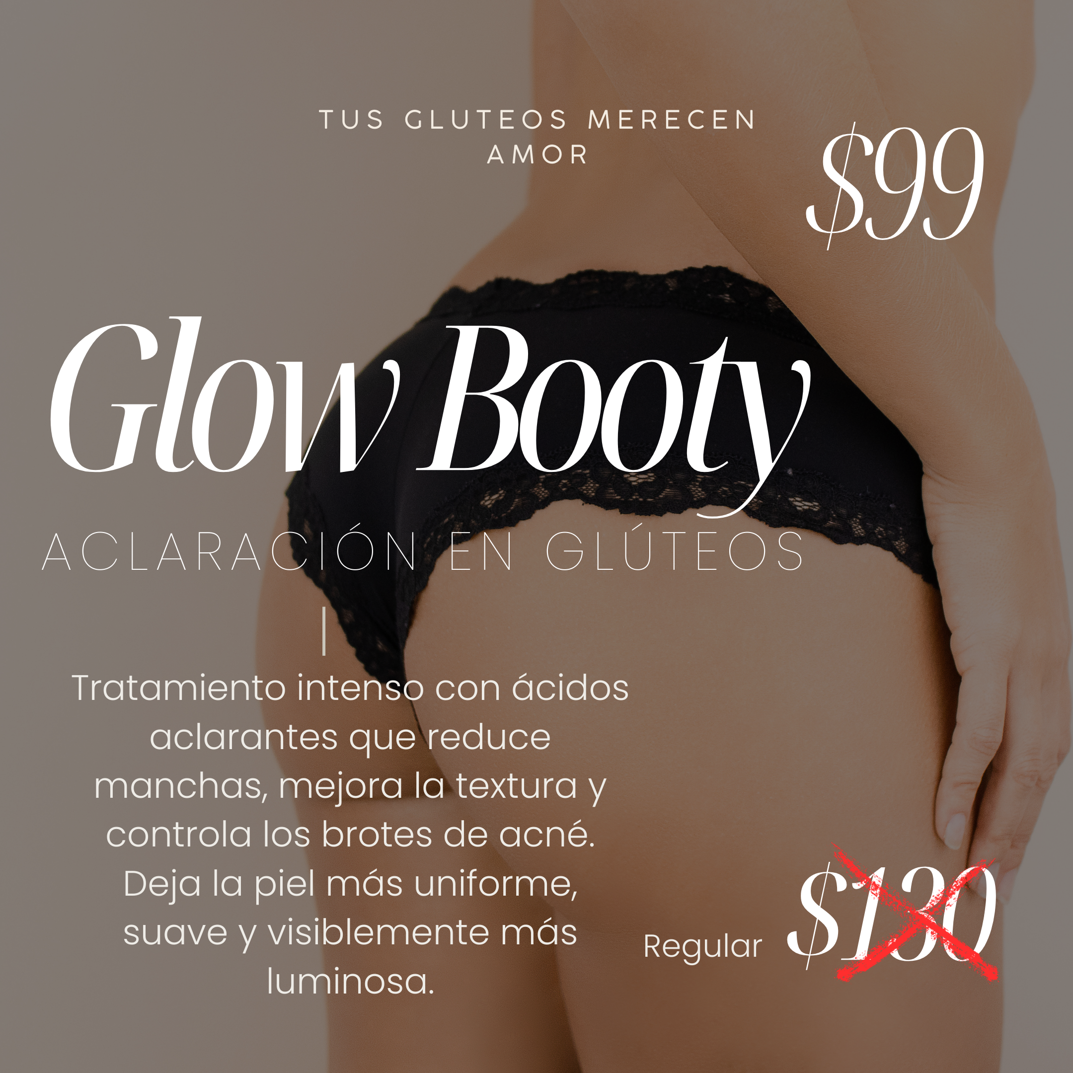 Glow Booty-Depósito de